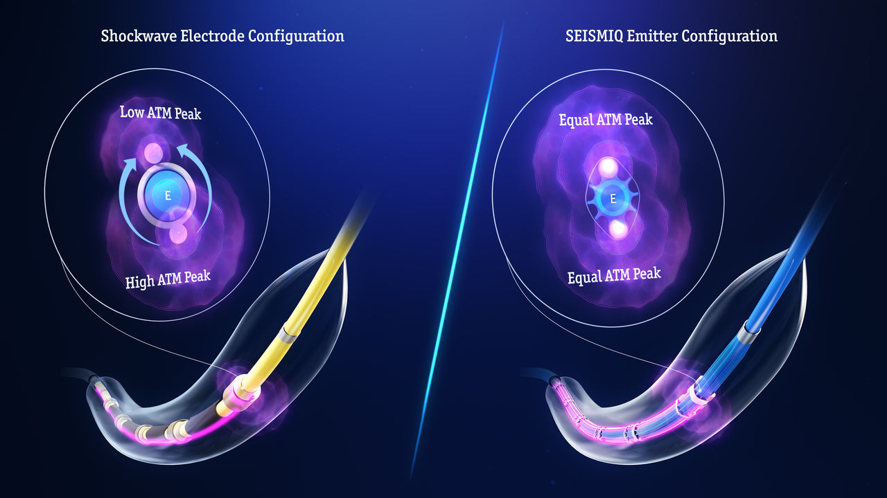 Shockwave electrode configuration vs SEISMIQ emitters configuration.