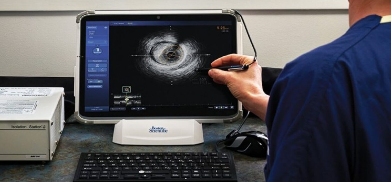 Healthcare professional holding stylus over screen of medical image with Boston Scientific logo below.