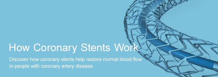 How Coronary Stents Work - Discover how coronary stents help restore normal blood flow in people with coronary artery disease.