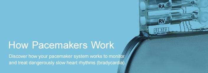 How Pacemakers Work - Discover how your pacemaker works to monitor and treat dangerously slow heart rhythms (Bradycardia).