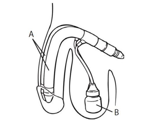 Diagram of implant with cylinders and pump