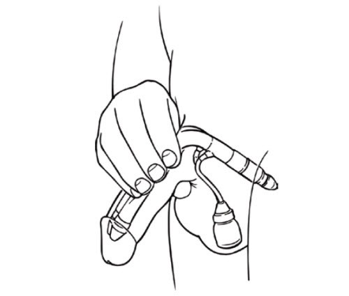 Illustration showing how to deflate your implant