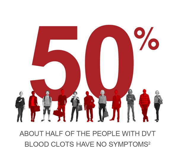 DVT Symptoms are not present in approximately 50% of people with deep vein thrombosis.