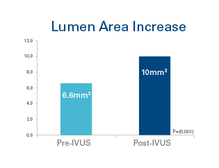 Lumen area increased from 6.6mm2 (pre-IVUS) to 10mm2 (post-IVUS), P=(0.001)