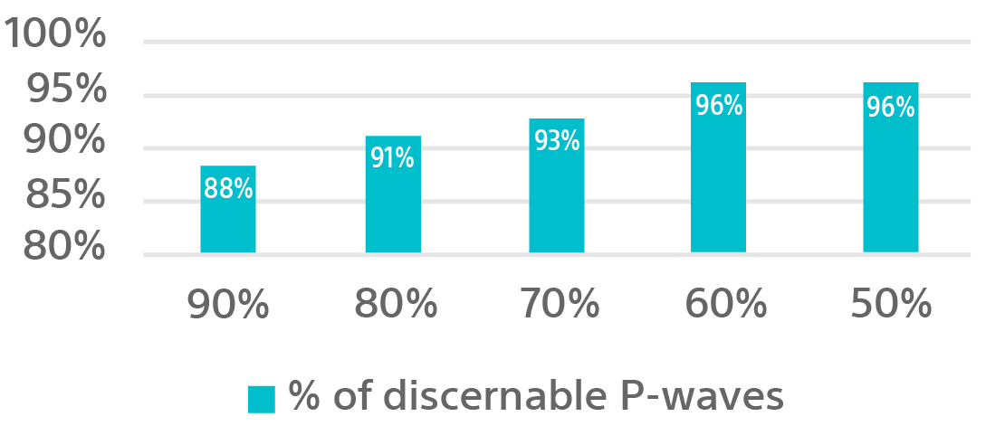 Data chart showing the P-Wave visibilty of the LUX-Dx Insertable Cardiac Monitor (ICM) System through 180 days post insertion.
