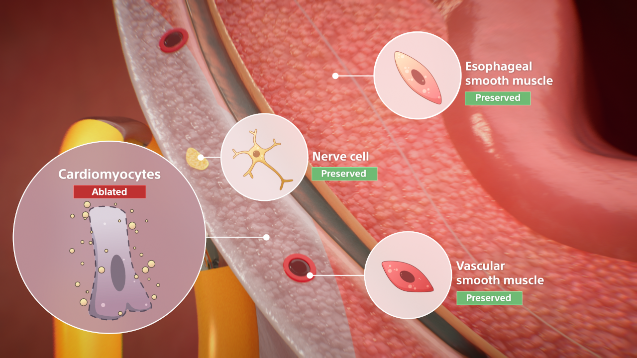 Selective Tissue Targeting