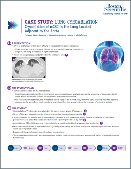 Lung mCRC Cryoablation case study 