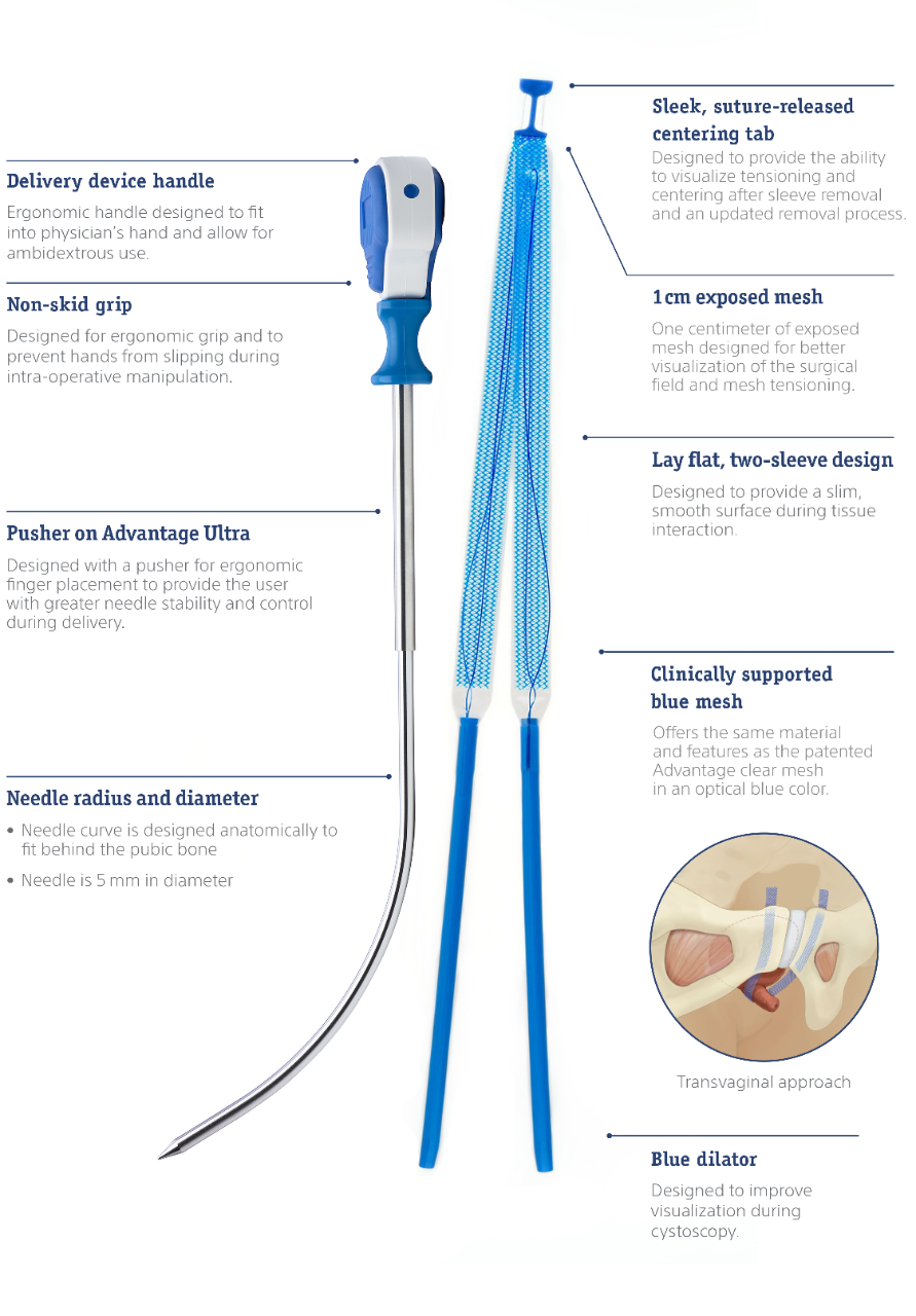 Trocar features: ergonomically designed handle with non-skid grip, dilator pusher and curved needle tip. Mesh features: sleek, suture-release centering tab, 1cm exposed mesh, lay flat two-sleeve design, clinically supported blue mesh and blue dilators. 