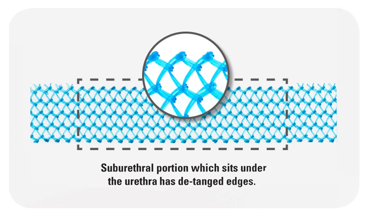 Obtryx II Transobturator MidUrethral Sling System Boston Scientific