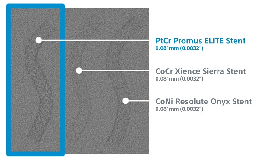 Flouro image comparing the visibility of the Promus ELITE Stent System with competitive drug-eluting stents