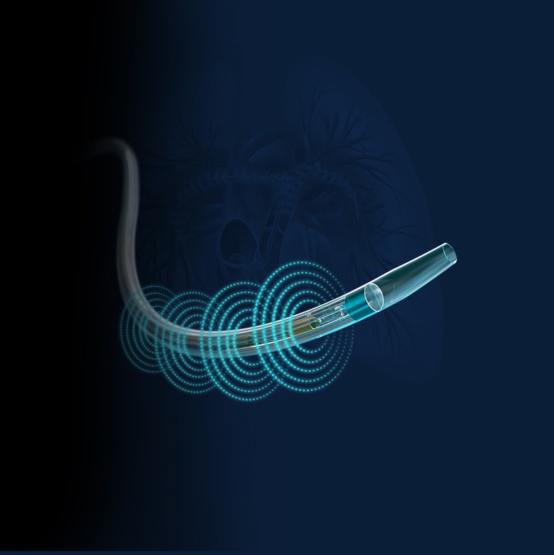 EKOS catheter with blue glowing circles