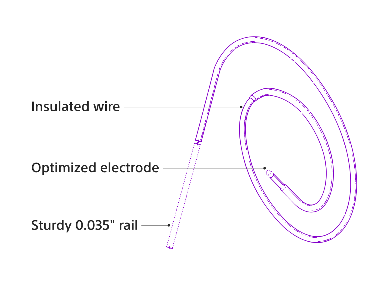 Detail of assembly showing smooth transition between FARADRIVE Steerable Sheath and VersaCross Connect Transseptal Dilator, and WATCHMAN TruSteer Sheath and VersaCross Connect Transseptal Dilator.