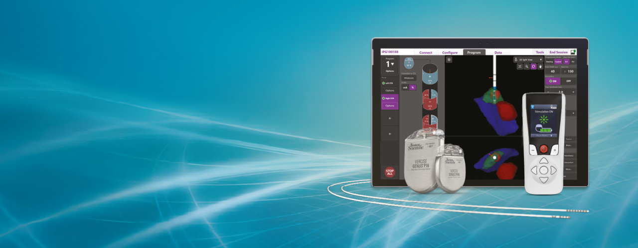 DBS mes del parkinson