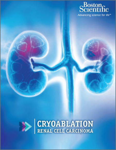 PDF Kidney Cancer Guideline summary