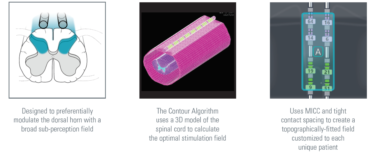 Boston Scientific SCS IPGs and surgical leads