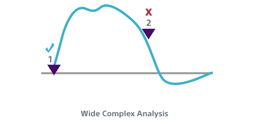 Wide Complex Analysis INSIGHT Technology algorithm.