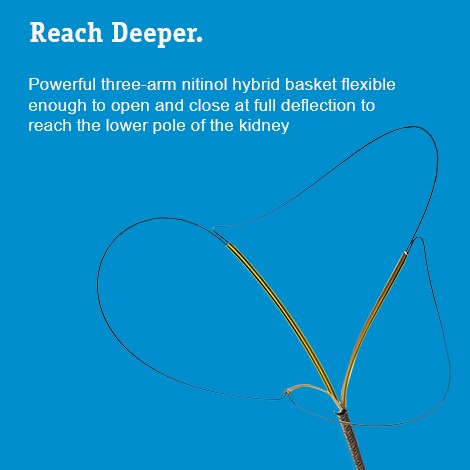 Llegar a lo más complejo. Potente cesta de tres brazos de híbrido de nitinol lo suficientemente flexible como para abrirse y cerrarse con una deflexión completa para poder llegar al polo inferior del riñón.