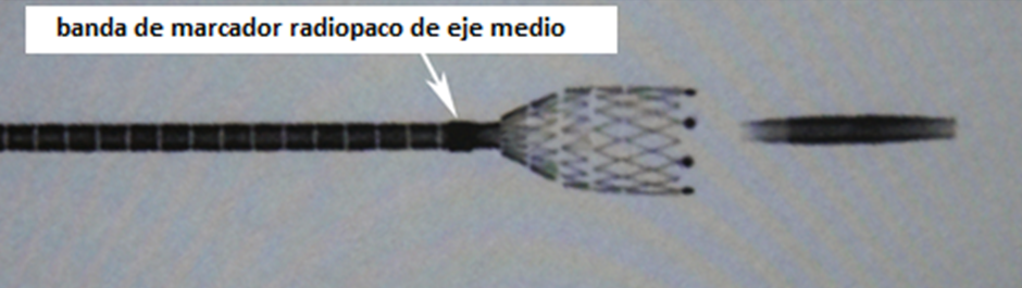 Middle shaft radiopaque marker band - deployment technique of Eluvia Stent System