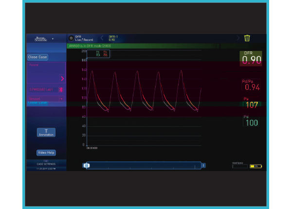 PhysioMap