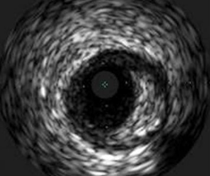 Eagle Eye Platinum 20 MHz