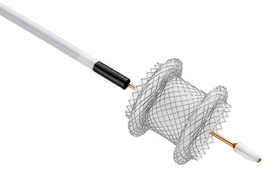 Stent AXIOS