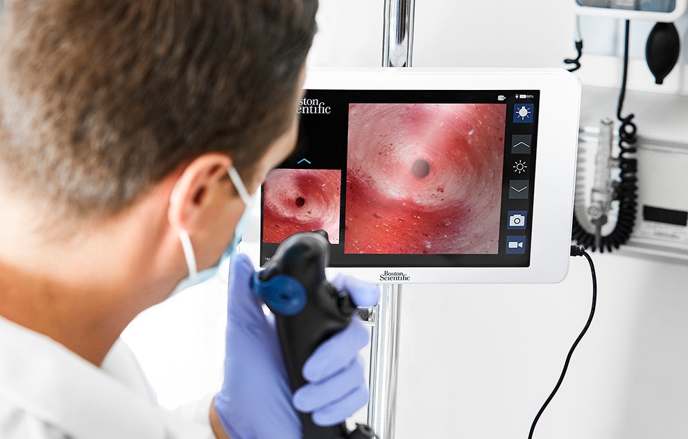 Healthcare provider uses EXALT Model B Single-Use Bronchoscope to see internal view of patient on screen.
