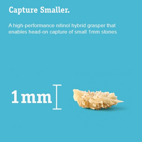 Capturar lo más pequeño. Capacidad para la captura frontal de cálculos de solo 1 mm de tamaño.