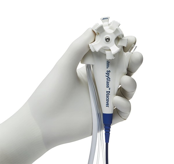 white gloved hand holding Spyglass Digital Catheter