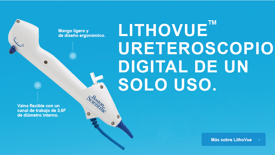 Ureteroscopio digital desechable LithoVue™