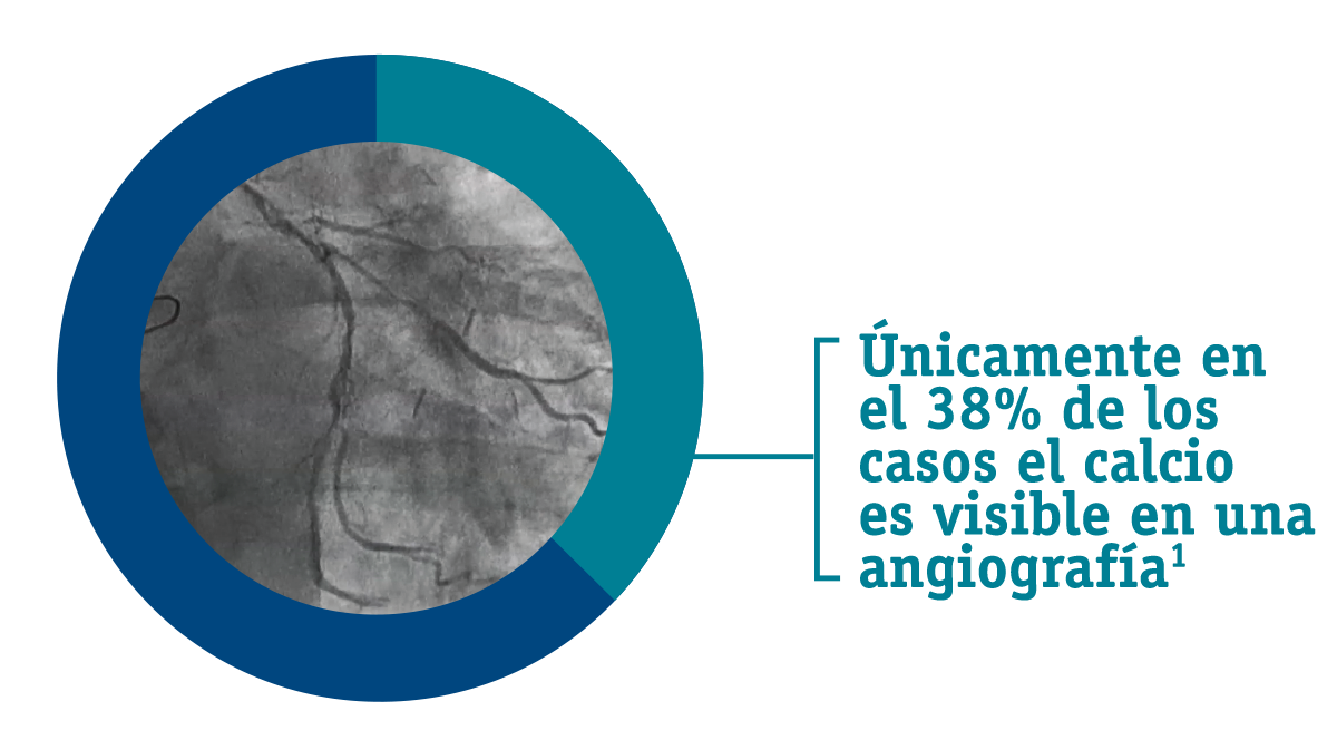 Angiography, for example, is successful at identifying calcium in only 38% of cases – essentially only effective in the most severe cases. 