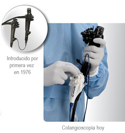 Primer colangioscopio y herramientas para la colangioscopía actual
