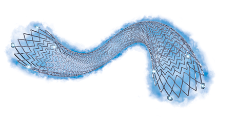 Eluvia Stent designed for flexibility, radial strength, fracture resistance