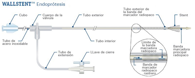 Diagrama detallado de la endoprótesis WALLSTENT™