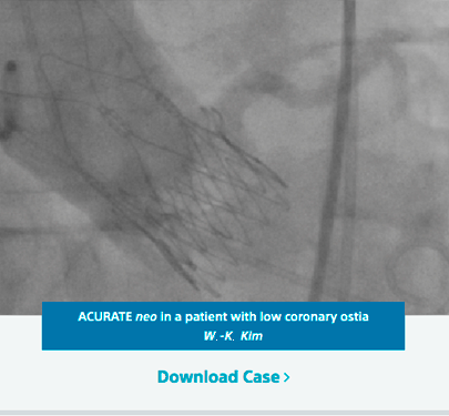 ACURATE neo in a patient with low coronary ostia