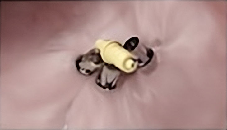 Foto de cierre del defecto