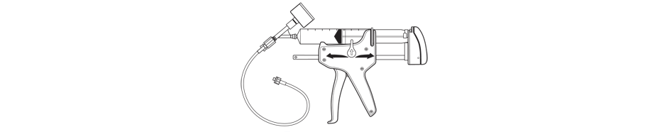 Alliance™ II Integrated Inflation/Lithotripsy Device
