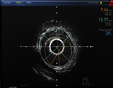 Radio image accurate