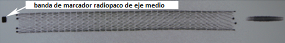 Eluvia Stent deployment technique