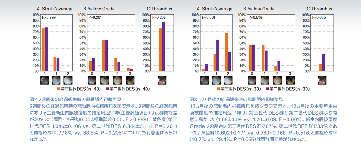 図2 2週間後の経過観察時の冠動脈内視鏡所見 図3 12ヵ月後の経過観察時の冠動脈内視鏡所見