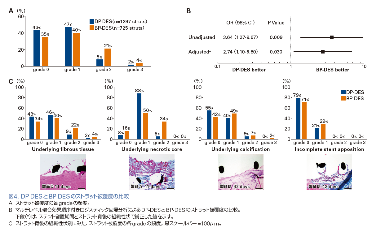 図4. DP-DESとBP-DESのストラット被覆度の比較