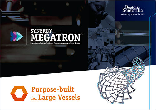 SYNERGY MEGATRON™ 製品カタログ
