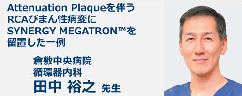 Attenuation Plaqueを伴うRCAびまん性病変にSYNERGY MEGATRON™を留置した一例