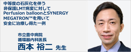 中等度の石灰化を伴う非保護LMT病変に対してPerfusion balloonとSYNERGY MEGATRON™を用いて安全に治療し得た一例
