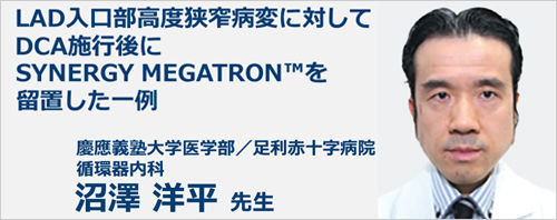 LAD入口部高度狭窄病変に対して DCA施行後にSYNERGY MEGATRON™を 留置した一例