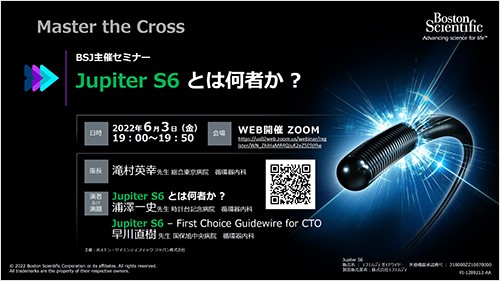 Jupiter S6とは何者か？