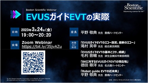 EVUSガイドEVTの実際