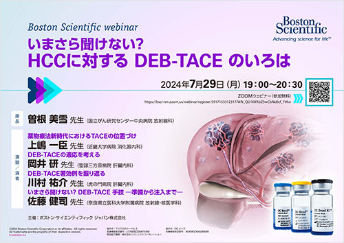 いまさら聞けない？HCCに対する DEB-TACE のいろは