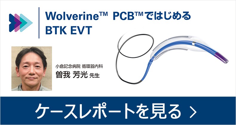 Wolverine™ PCB™ではじめる BTK EVT