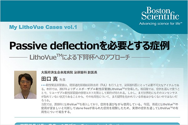 My LithoVue Cases vol.1