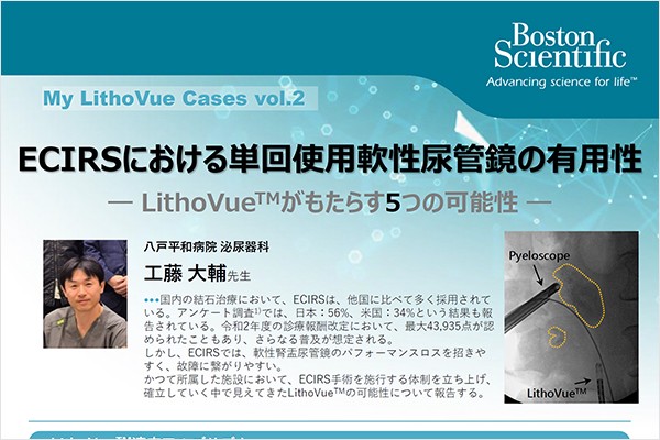 My LithoVue Cases vol.2